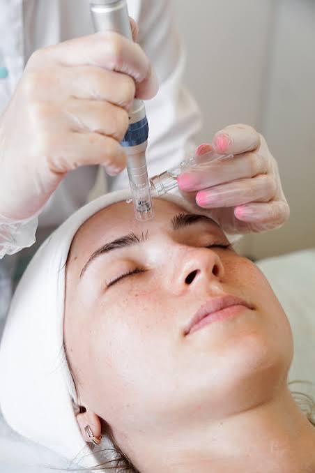 Illustrative photograph of a treatment device on the forehead.