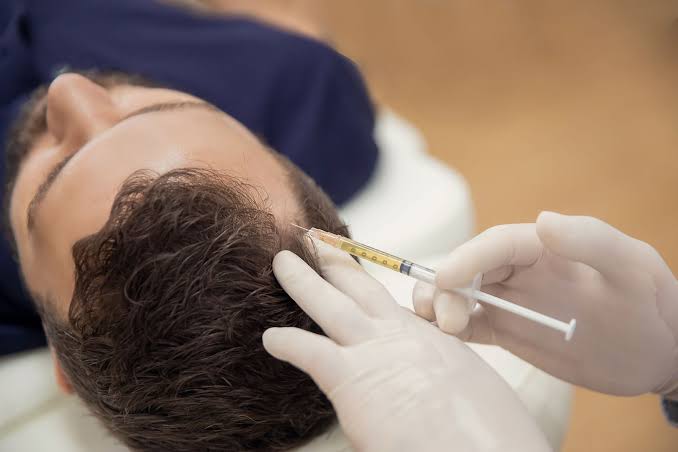 Illustrative photograph of an injection into the scalp.