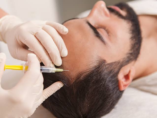 Illustrative photograph of an injection along the hairline.