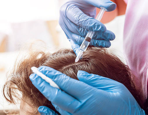Illustrative photograph of an injection into the scalp.