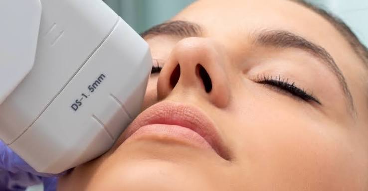 Illustrative photograph of an ultrasound handpiece on the face.
