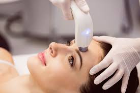 Illustrative photograph of a laser handpiece on the cheek.